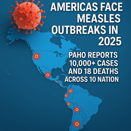 Americas Face Measles Outbreaks in 2025: PAHO Reports 10,000+ Cases and 18 Deaths Across 10 Nations