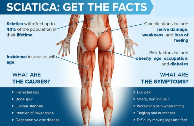 Sciatica, Nerve, Joint, Bone & Cartilage Supplements