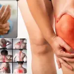 Rheumatism: Symptoms, Causes, Types, Diagnosis & Treatment Medicine