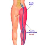 Nerve Inflammation Causes, Symptoms & Treatment Medicine