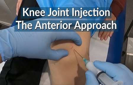 Intra-articular Knee Injection: Side Effects, Contraindications & All You Need To Know