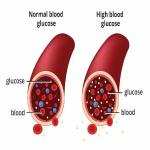 High Blood Sugar Treatment Medicine in Ghana