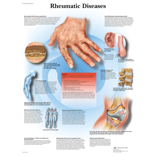Rheumatic Diseases: Symptoms, Types, Medication, and Rheumatologist Guide