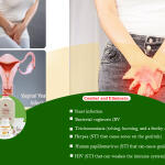 Vaginal Infections Treatment Medicine in Ghana