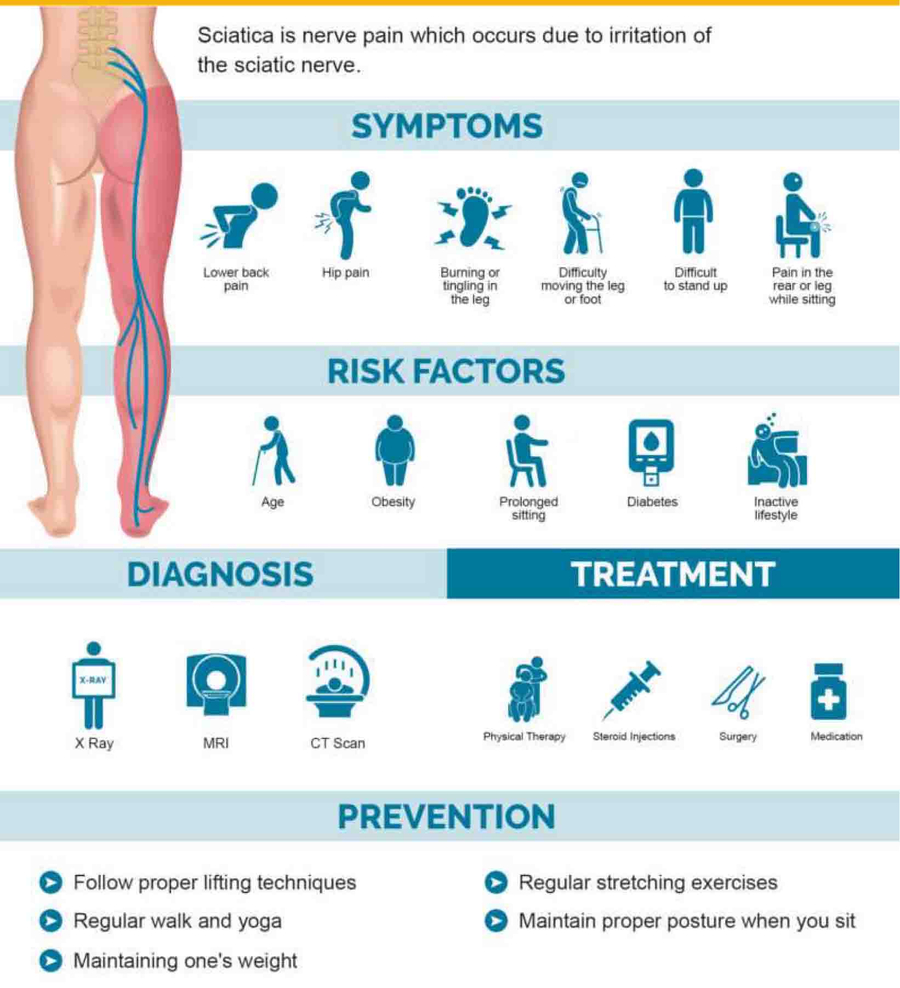 Sciatica symptoms