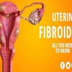 Fibroids Treatment Medicine Without Surgery in Ghana