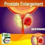Prostate Enlargement Treatment Medicine in Ghana
