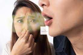 Major Causes of Halitosis & Bad Breath with Treatment Supplements