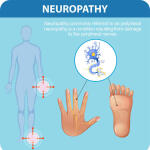 Causes of Peripheral Neuropathy in Feet and Legs: Preventive Strategies & Effective Treatment Supplements