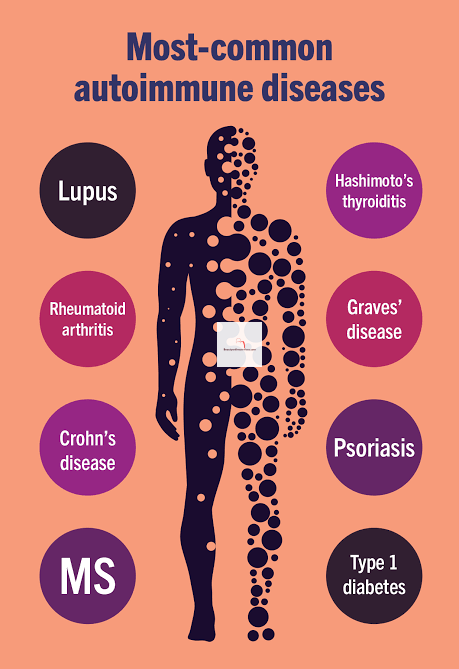 What is an Autoimmune Disease? Why is it Often Undiagnosed ?