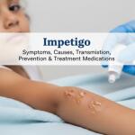 Impetigo: Symptoms, Causes, Transmission, Prevention & Treatment Medications