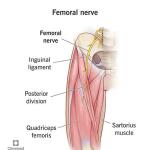 Femoral Nerve Pain (Femoral Neuropathy) in the Thigh: Causes, Fast Relief Strategies & Effective Treatment Supplements