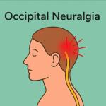 Neck and Head Nerve Pain (Occipital Neuralgia): Causes, Preventive Strategies & Effective Treatment Supplements