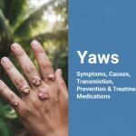 Yaws: Symptoms, Causes, Transmission, Prevention & Treatment Medications
