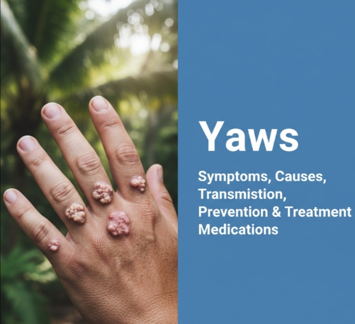Yaws: Symptoms, Causes, Transmission, Prevention & Treatment Medications