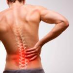 Sciatica Caused by Muscle Strain in the Lower Back: Preventive Strategies & Effective Treatment Supplements