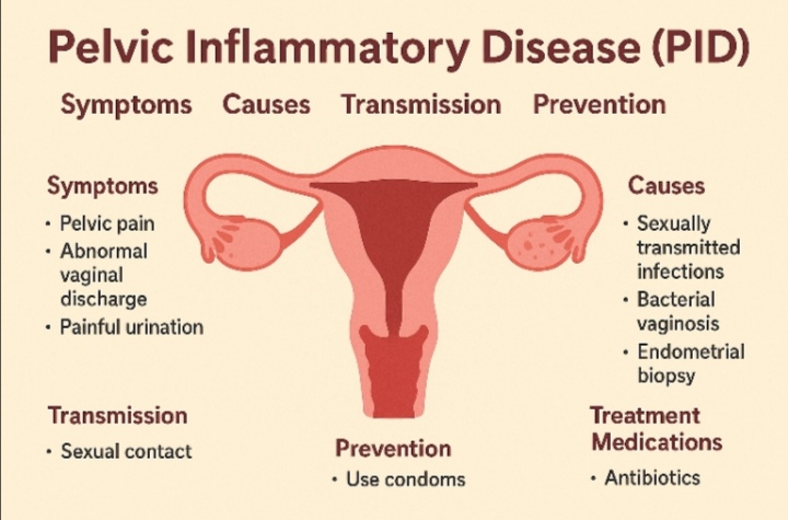Pelvic Inflammatory Disease (PID): Symptoms, Causes, Transmission, Prevention & Treatment Medications