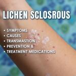 Lichen Sclerosus: Symptoms, Causes, Transmission, Prevention & Treatment Medications
