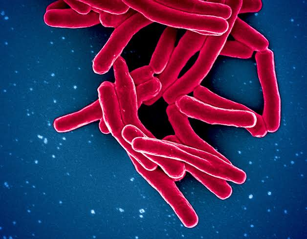 Tuberculosis (TB): Causes, Types, Symptoms, Prevention & Effective Medications