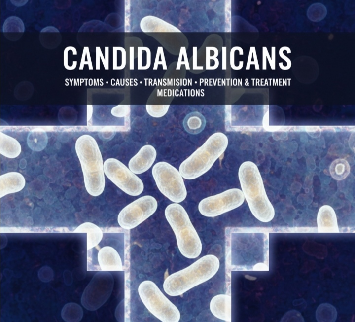 Candida Albicans: Symptoms, Causes, Transmission, Prevention & Treatment Medications