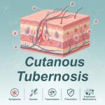 Cutaneous Tuberculosis: Symptoms, Causes, Transmission, Prevention & Treatment Medications