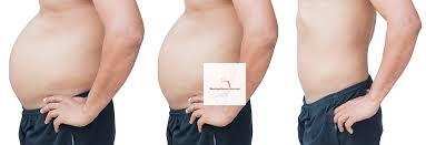 How to Loose Belly Fat Naturally Through Exercise & Detoxification