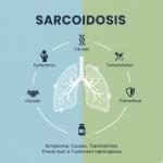 Sarcoidosis: Symptoms, Causes, Transmission, Prevention & Treatment Medications