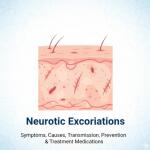 Neurotic excoriations: Symptoms, Causes, Transmission, Prevention & Treatment Medications