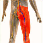 Last Stage Sciatica: Symptoms, Causes, Preventive Strategies & Effective Treatment Supplements