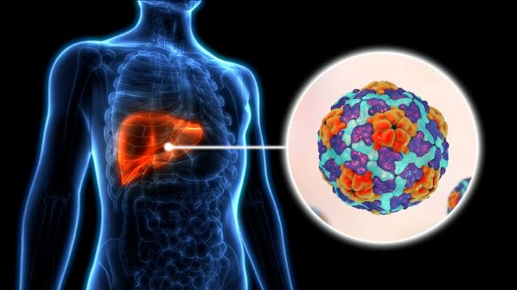 Hepatitis A Infection: Causes, Symptoms, Prevention, and Treatment Options