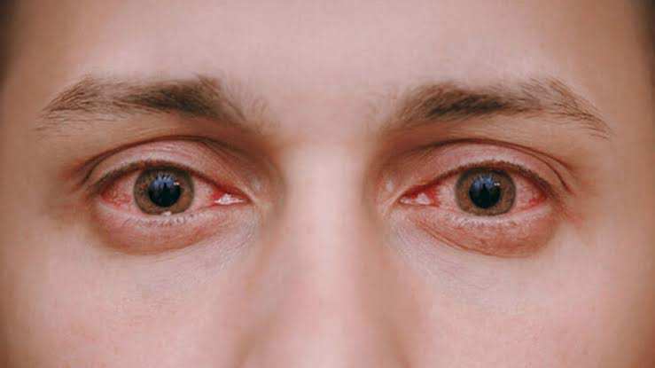 Eye Health Supplements: Natural Solutions That Truly Work for Chronic Eye Problems