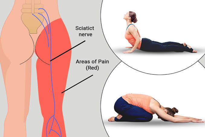 Effective Stretches and Postures for Sciatica Relief & Prevention