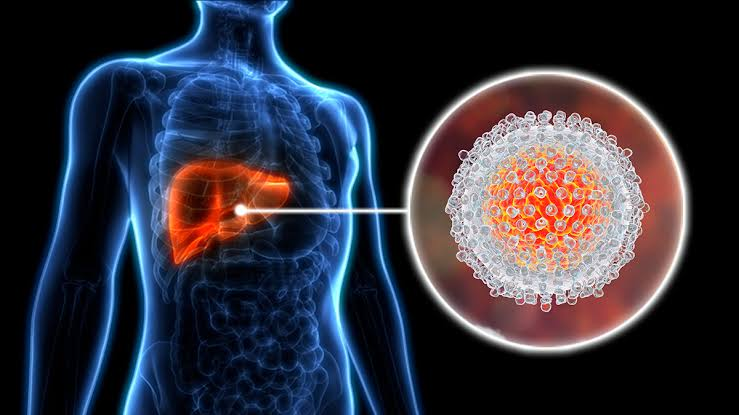 Hepatitis C Infection: Causes, Symptoms, Transmission, Prevention Strategies & Medications