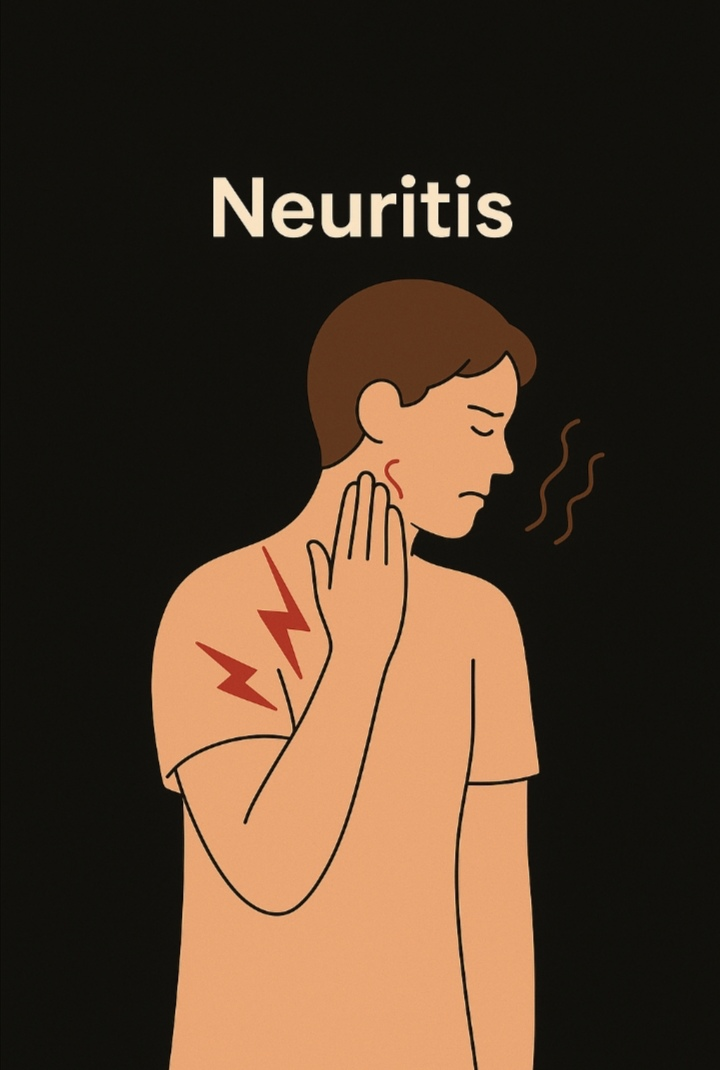 Nerve Inflammation (Neuritis): Causes, Symptoms, Preventive Strategies & Effective Treatment Supplements