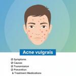 Acne vulgaris: Symptoms, Causes, Transmission, Prevention & Treatment Medications