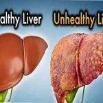 Liver Detox Supplements: Natural Ways to Support Liver Repair and Function