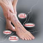 Neuropathy Pain Treatment Medicine in Ghana
